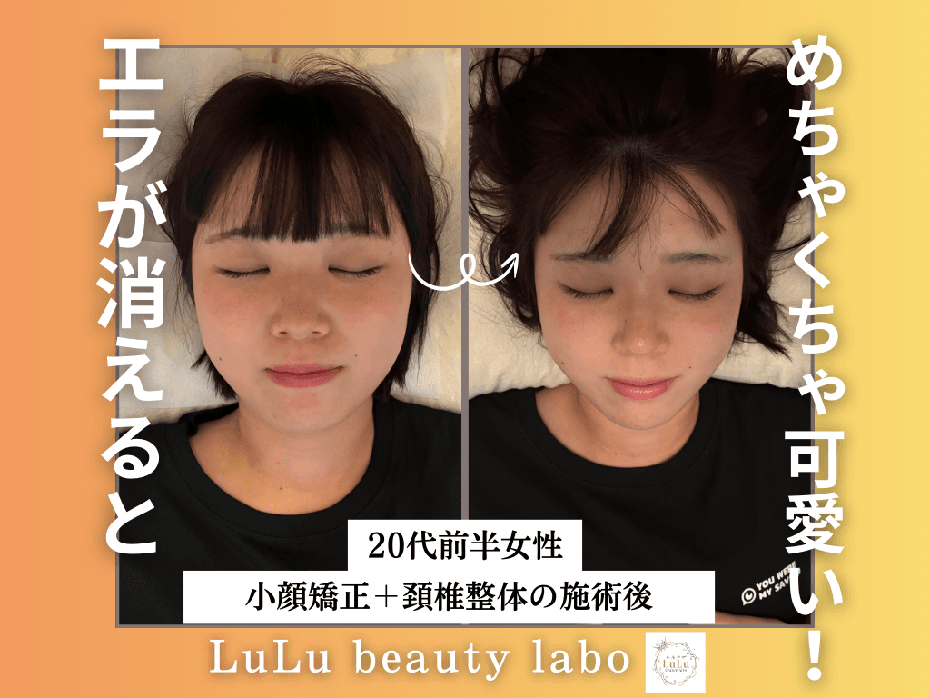 【顔を小さくしたい方!!】理学療法士の小顔矯正&頚椎整体《施術時間80分》