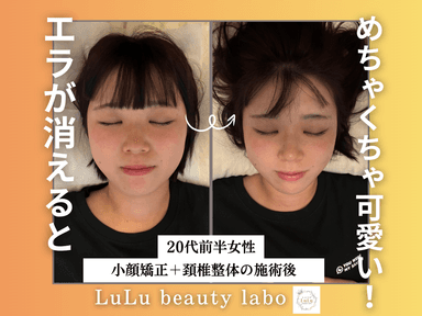 【顔を小さくしたい方!!】理学療法士の小顔矯正&頚椎整体《施術時間80分》