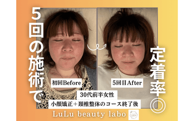 【浮腫みやすい方必見!!】小顔矯正&小顔リンパ《80分コース》¥13200→¥6,600