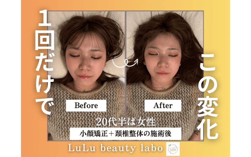 【人気&効果No.１☆】小顔矯正&美容整体《全身120分コース》¥22,000→¥11,200