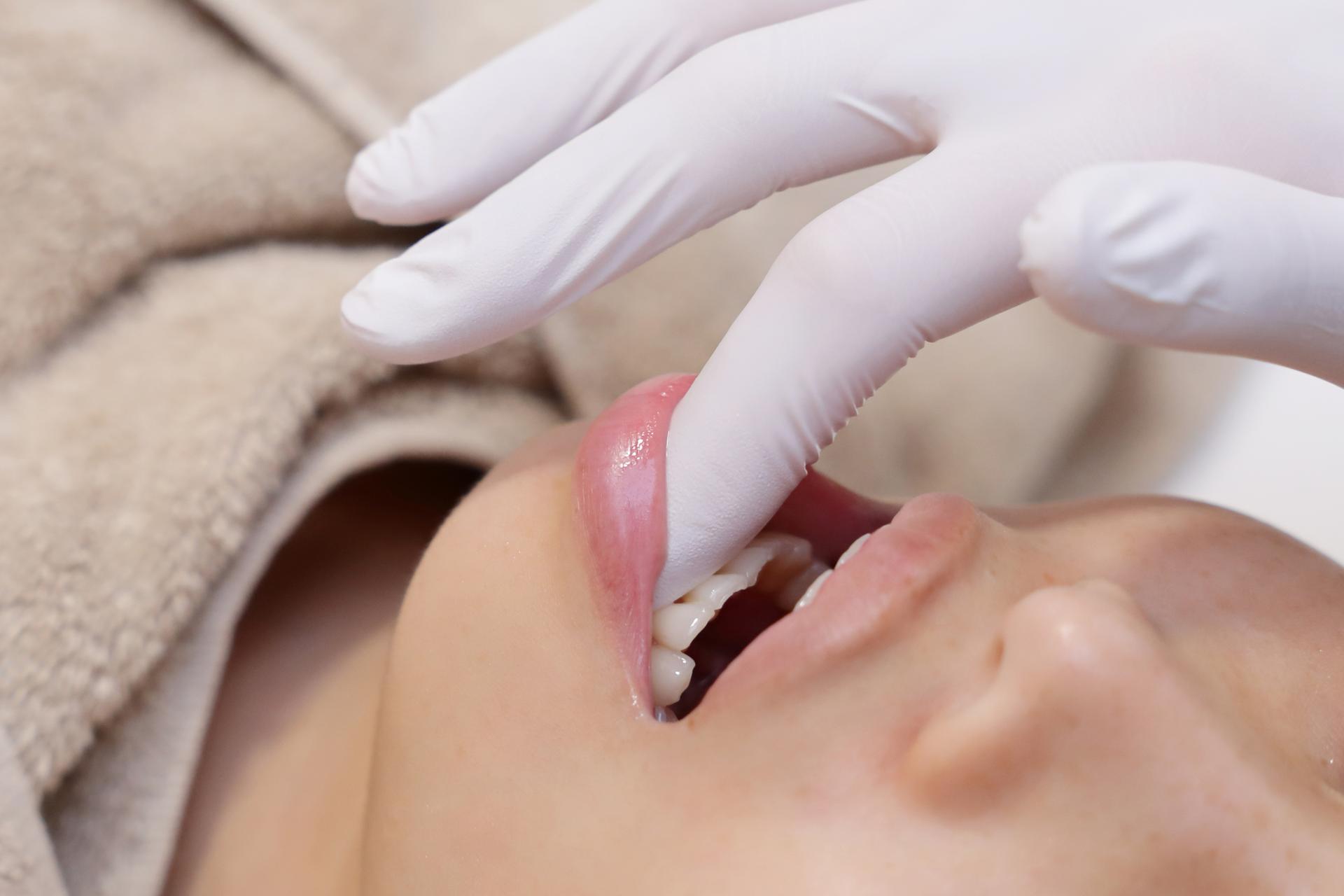 【半年集中12回】【食いしばり根本ケアコース】【長年の食いしばりにお悩みの方】通常料金¥8,000→¥6,000 