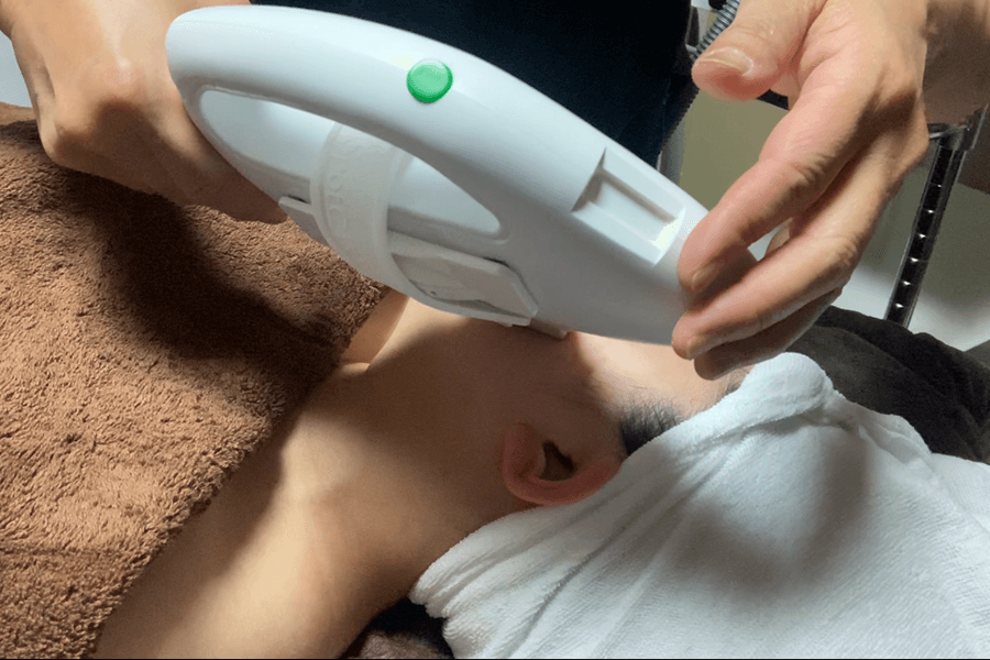 【2回目以降の方はこちら】【レディース&キッズ脱毛】ウルピカ脱毛4部位 60分