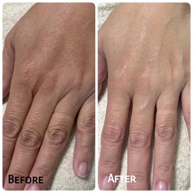 【手のケアに♪】ハリのあるふっくらした手に美容液導入￥2,980→￥2,480