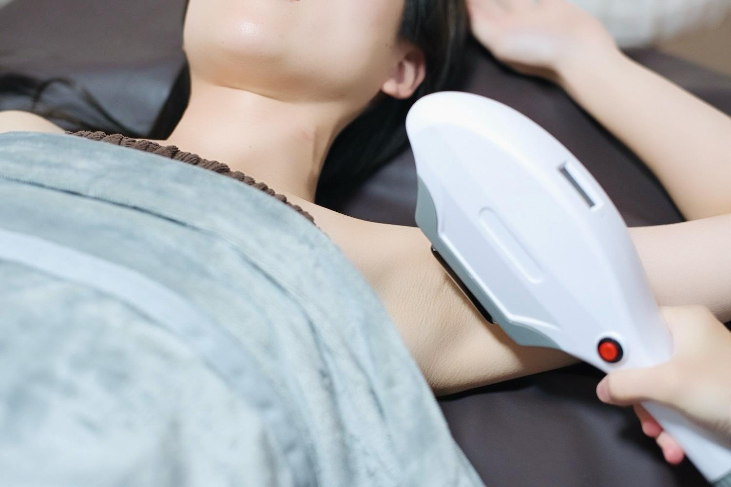 両ワキ脱毛 5分