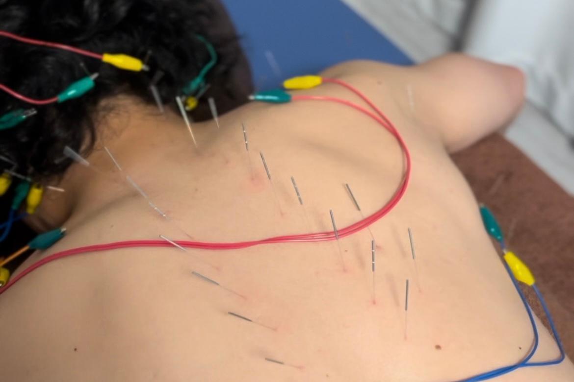 【新規限定】オーダーメイドケア【鍼治療＋整体を重点的に】80分