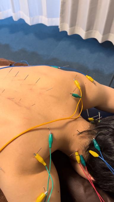 【新規限定】オーダーメイドケア【鍼治療＋整体を重点的に】110分