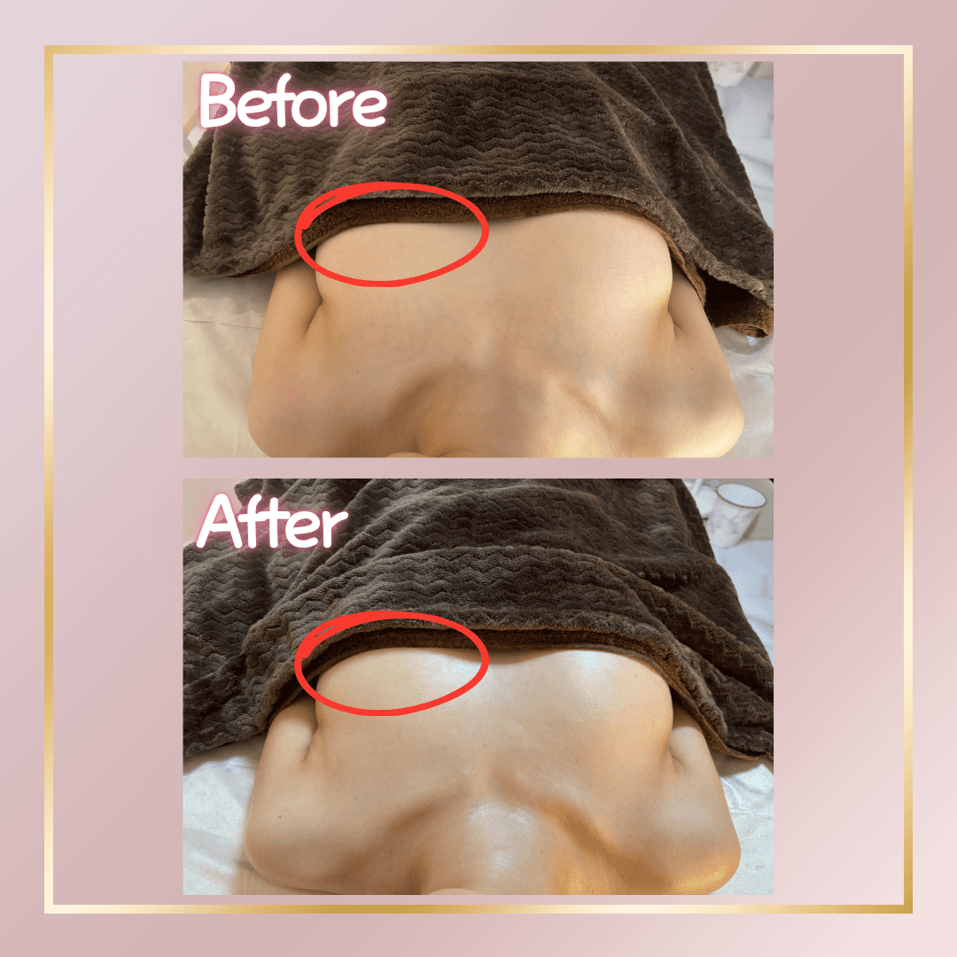 【バストお気軽メニュー】通常のバスト＋上半身ケアよりもコンパクトな内容です！最新NRマシン使用！