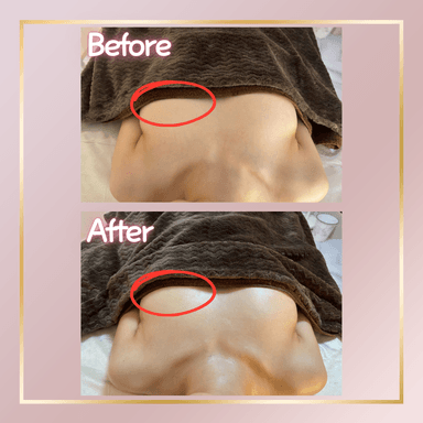 【バストお気軽メニュー】通常のバスト＋上半身ケアよりもコンパクトな内容です！最新NRマシン使用！