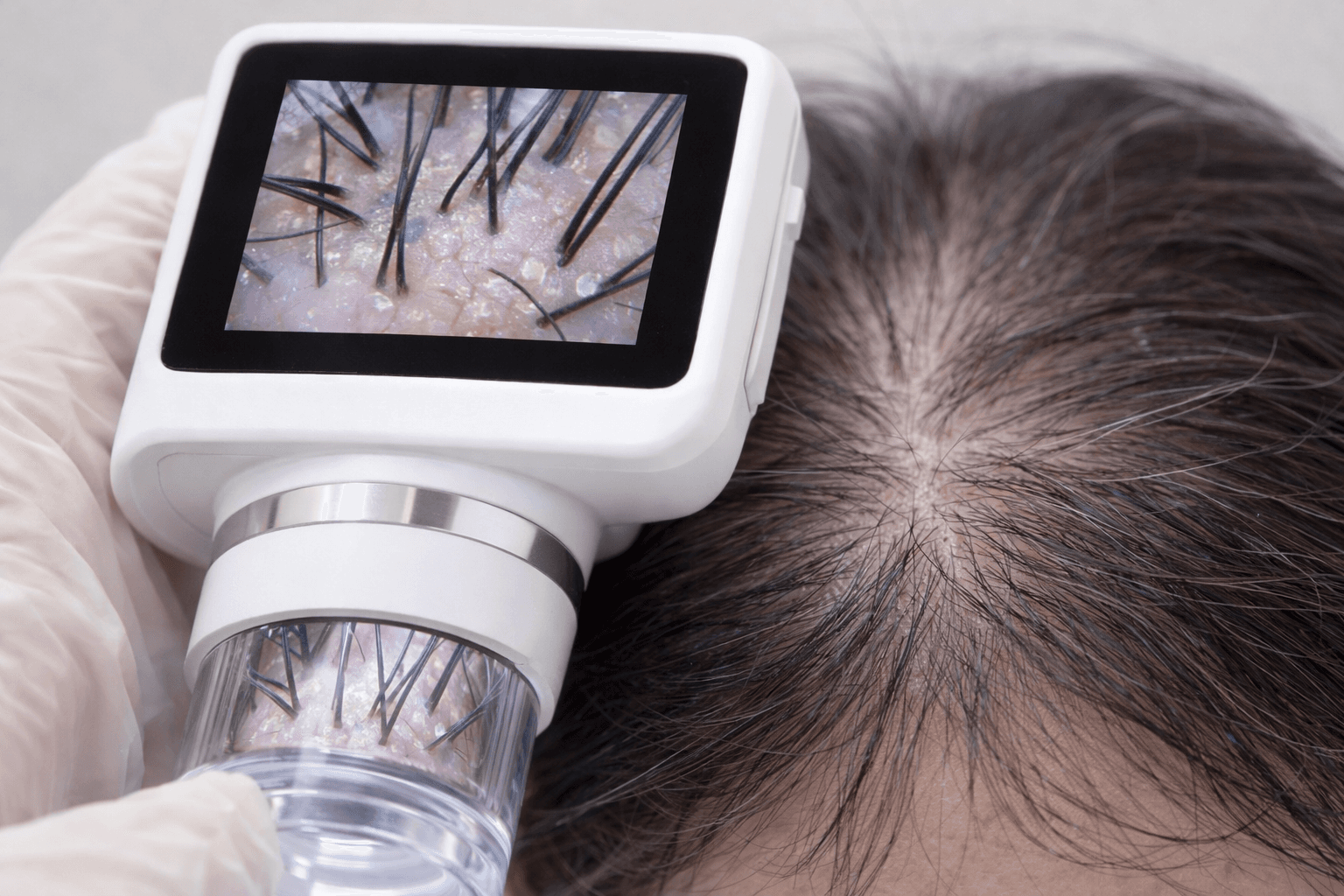 頭皮カウンセリング