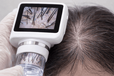 頭皮カウンセリング