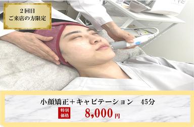 ≪脂肪分解でスッキリ小顔≫～小顔調整＋キャビテーション～45分