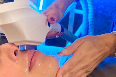 【新規限定】【メンズ脱毛】ヒゲ脱毛 15分 通常料金4,500円