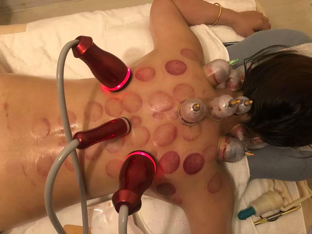 【首肩コリ解消】温熱療法中国式経絡オイルマッサージ吸い玉カッサ65分8000円