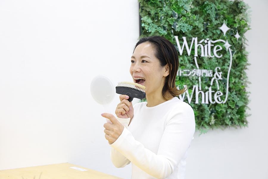 ブライダルセルフホワイトニング 30分