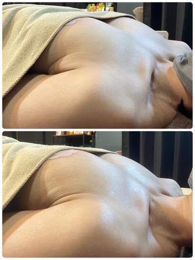 【NR機】　バストアップ＆美乳改善(60分)　12000円