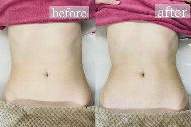 【NR機】ウエストくびれ調整　(60分)　7000円