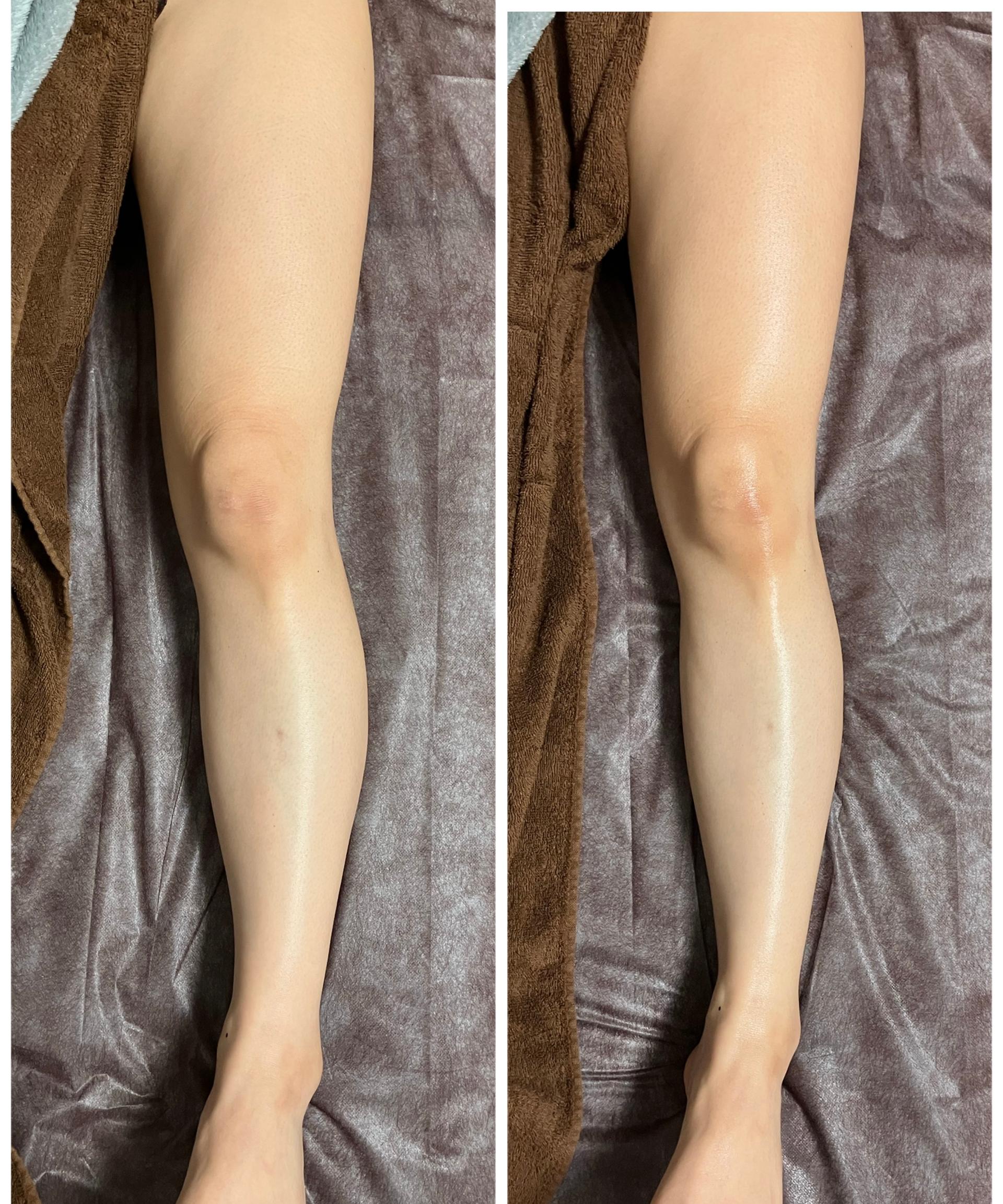 【NR機】美脚調整　(60分)　7000円