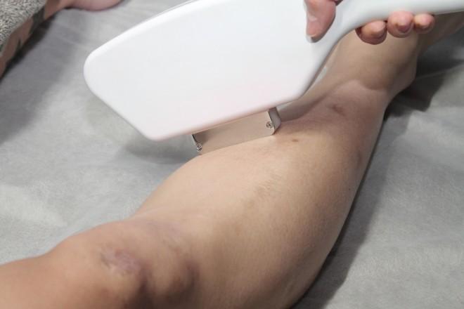 【新規限定】全身セット(顔、VIO含む) 