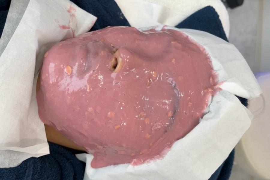 スノーピール+カスマラマスク 75分