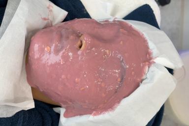 スノーピール+カスマラマスク 75分