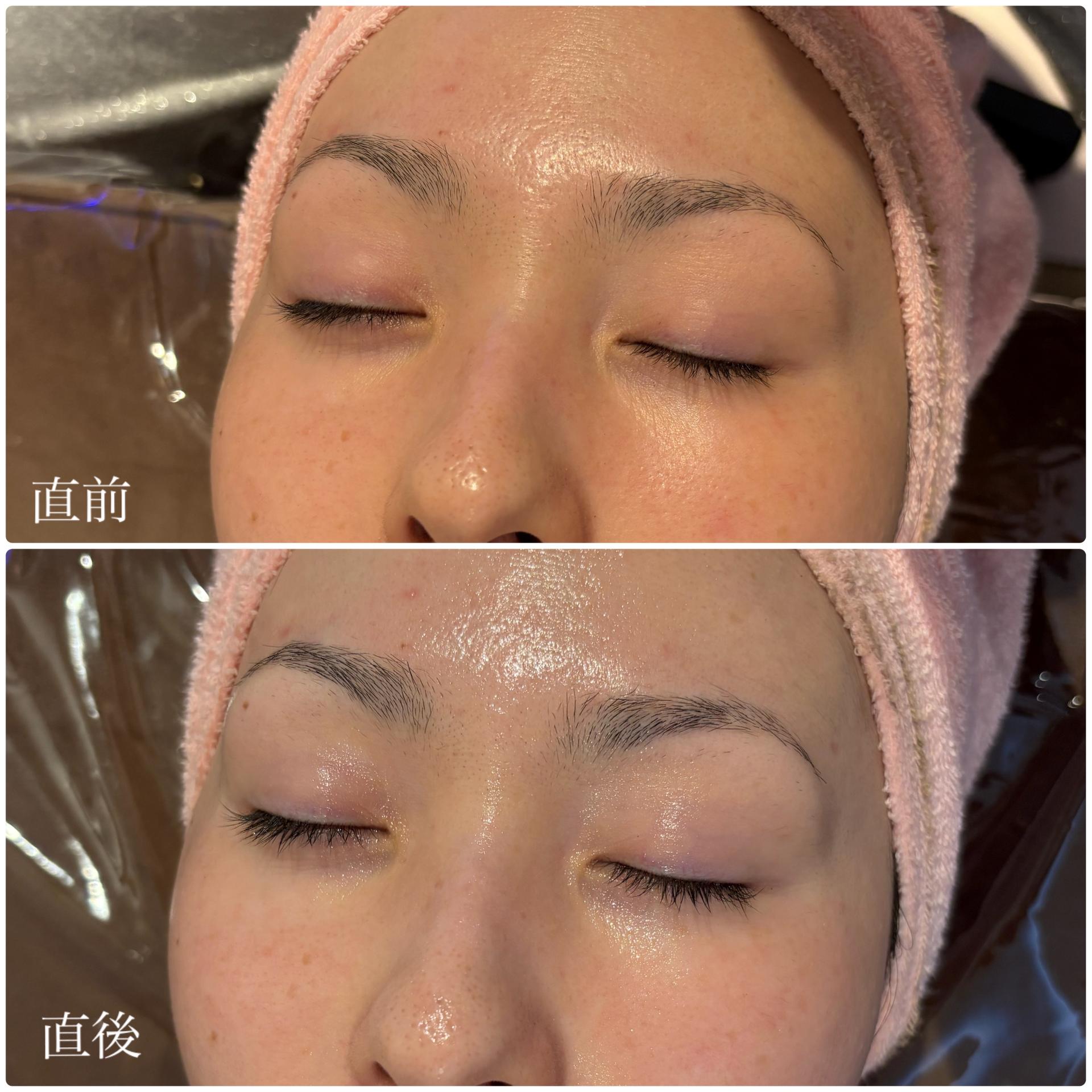 おすすめ！【水光肌ハーブピーリング＆美容液導入】剥離なし◎90分