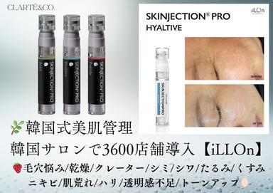 【新規】速効性”特許取得”エステ版ポテンツァ通常料金￥19500-