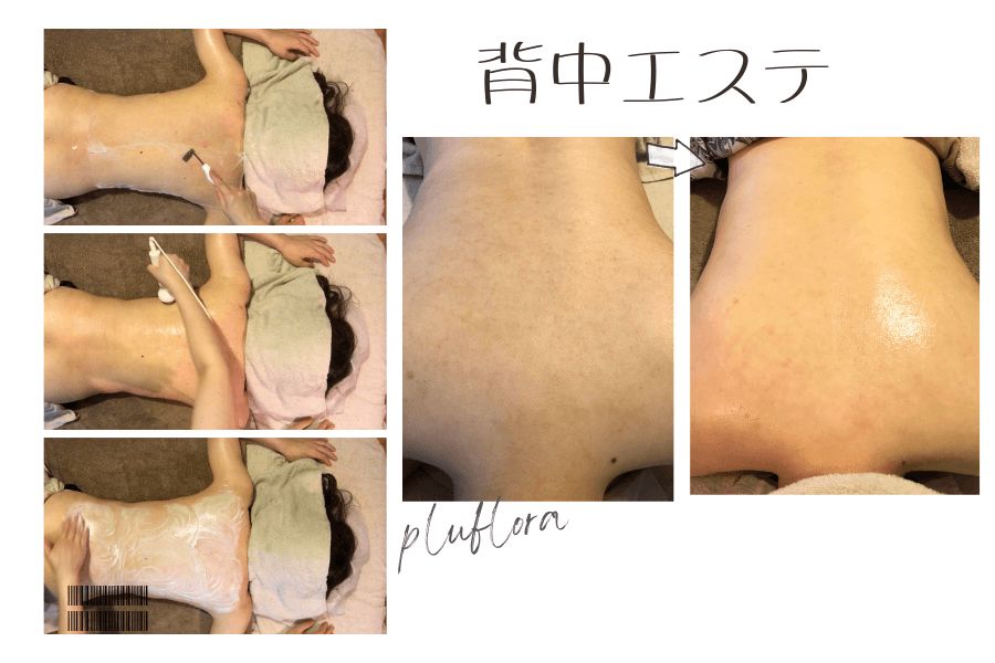 【背中美肌コース】プラセンタ☆リンパマッサージ+潤いケア 60分