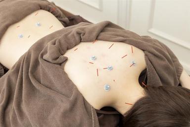 オーダーメイド全身鍼 60分