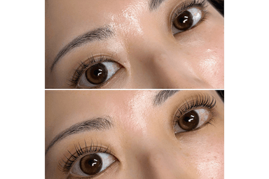 【etebeリフト】コスメリフト＋ブラックカラー+美容液botx 120分