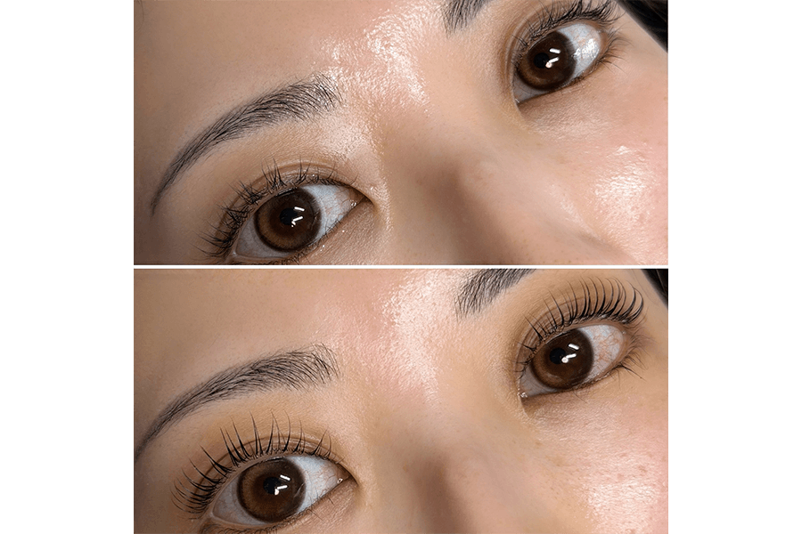 【新規限定】【etebeリフト】コスメリフト＋ブラックカラー+美容液botx 120分 通常料金9,000円