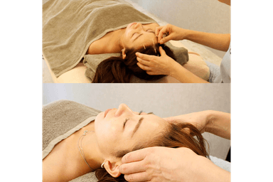 頭皮電気鍼＋頭皮首肩マッサージ 45分