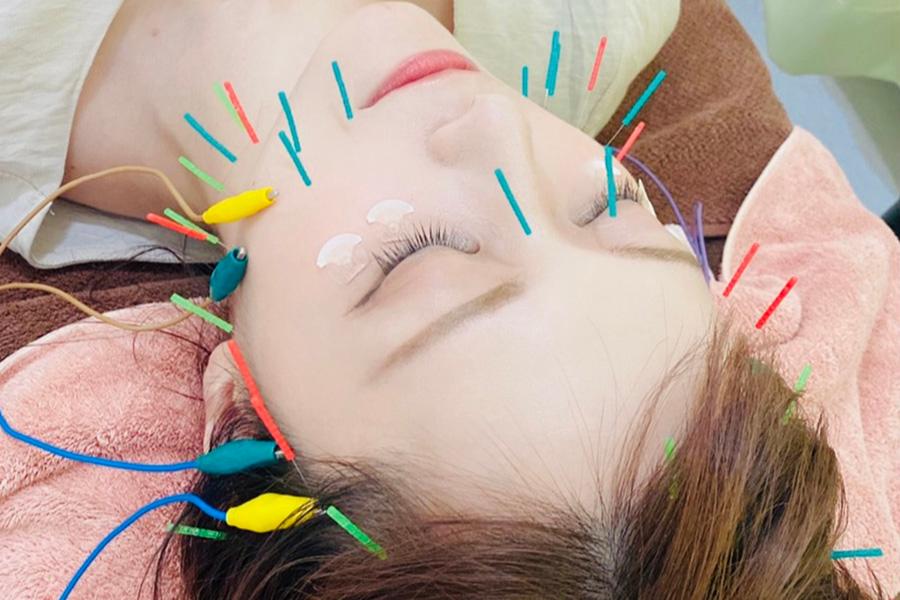 人気No.2【美容鍼プレミアム&全身整体リンパマッサージ】 90分