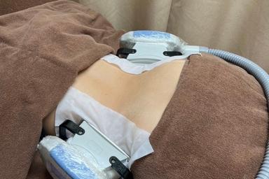 【新規限定】【男性気になる腰肉退治！しぶとい腰回りに！脂肪冷却2ヘッド、キャビ付】 50分