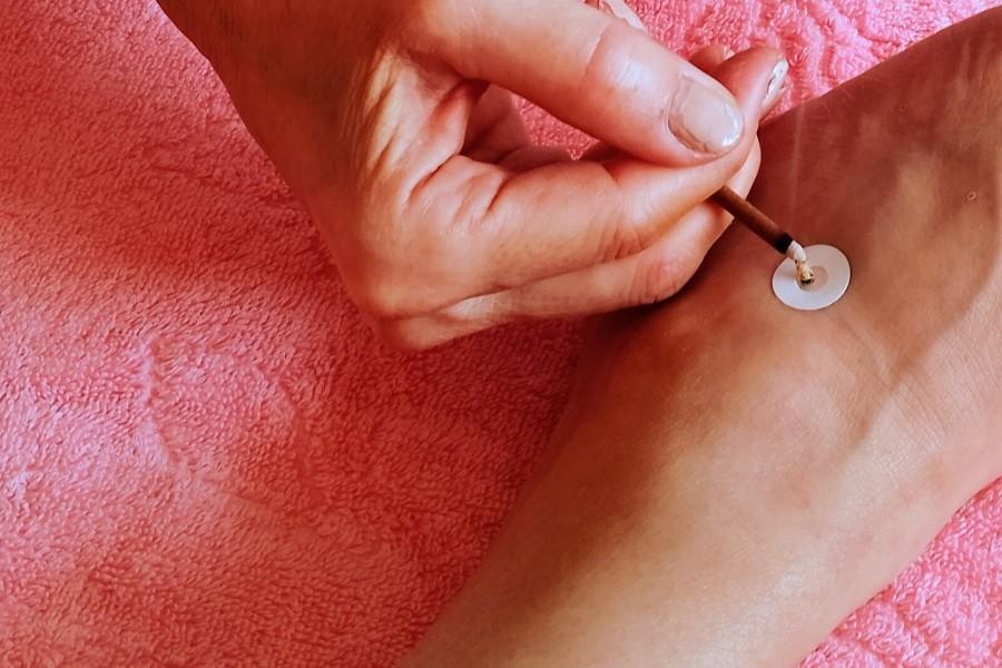 【新規限定】全身鍼灸 60分 通常料金4,000円