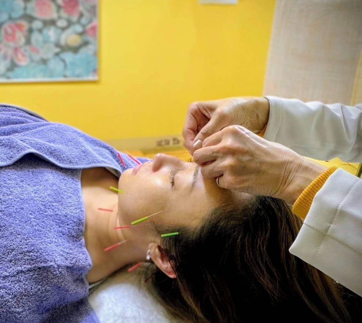 ≪人気NO.１≫小顔美容鍼＋深層ヘッドスパ＋デコルテ流し＋ヒト幹細胞美容液