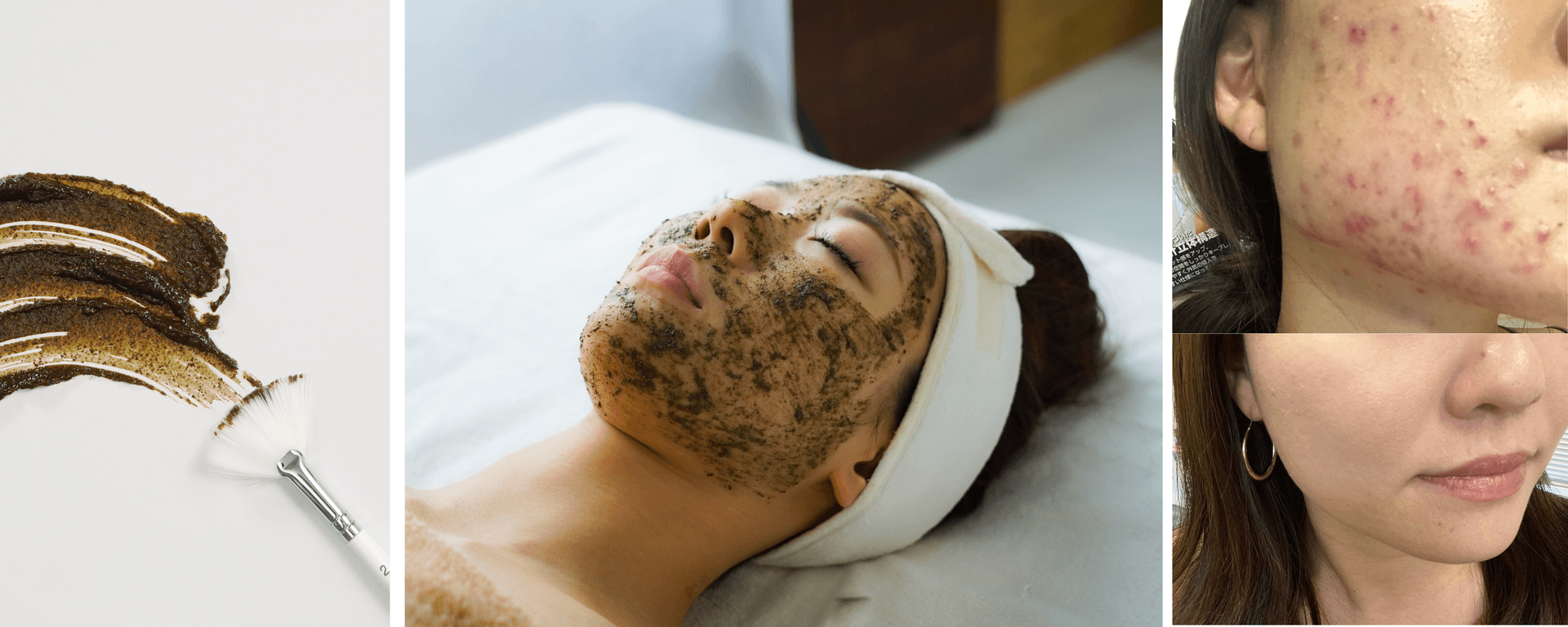 人気No.1【劇的肌質改善】肌が生まれ変わるハーブリプロ  70分