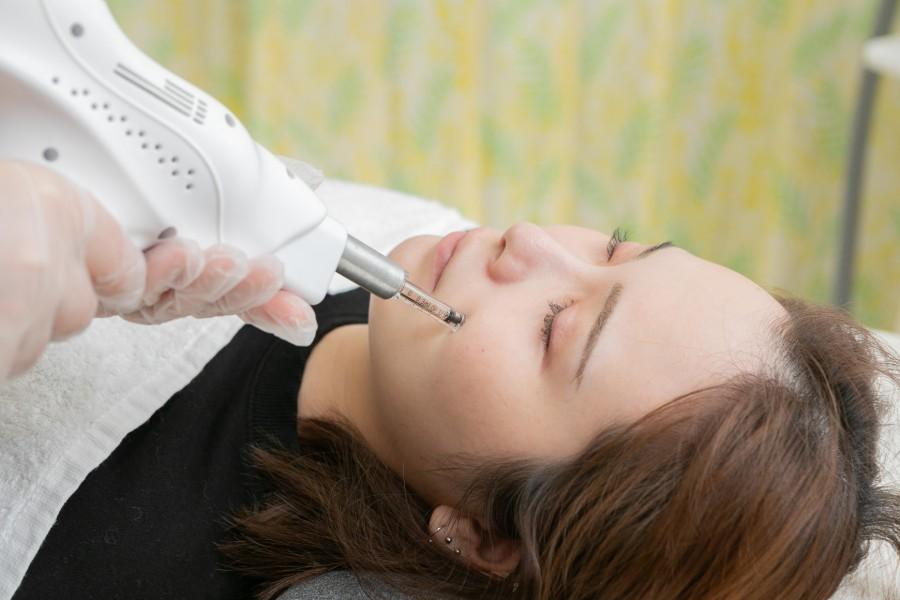 《ご希望の部位に♪》エイジングショット CHTOV 30shot 30分