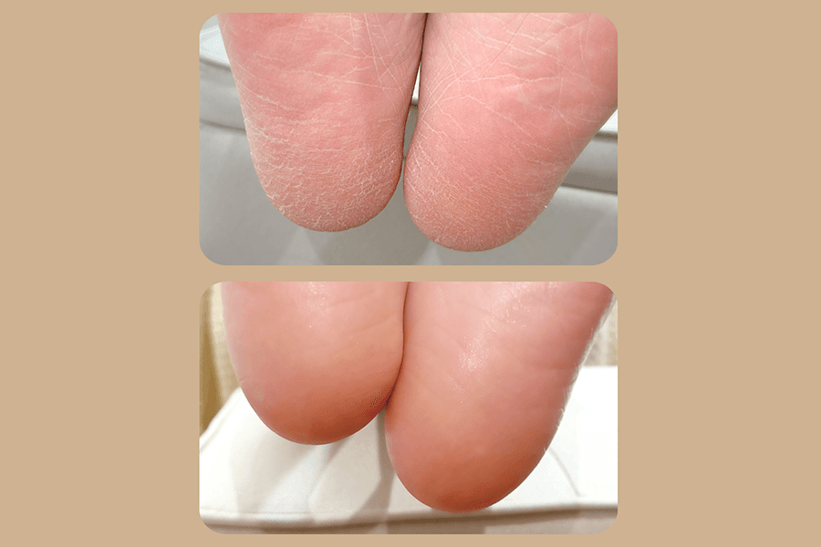 足裏角質ケア(スタンダード)