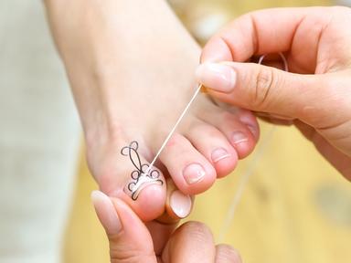 【新規限定】【巻き爪矯正】無料相談、カウンセリング☆ 30分