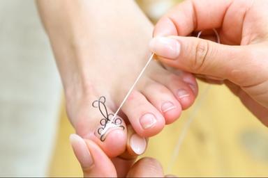 【新規限定】【巻き爪矯正】フットバス、丁寧ケア、装具込み 90分