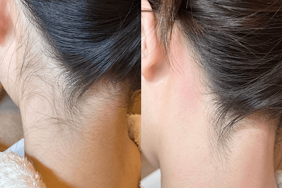 【新規限定】【うなじワックス脱毛】30分でつるつる美うなじへ　 30分 通常料金3,300円