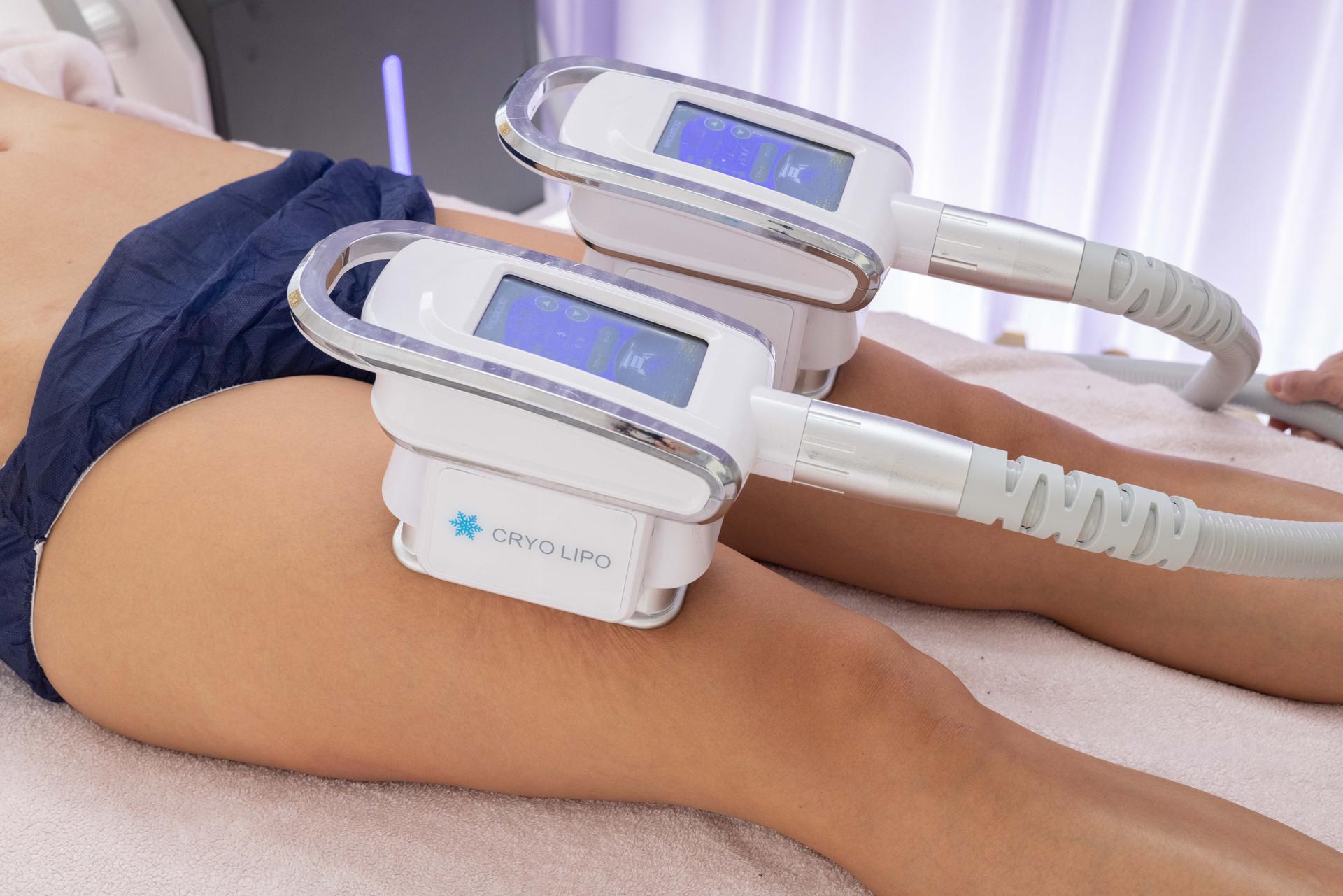 脂肪冷却【2カップ】30分