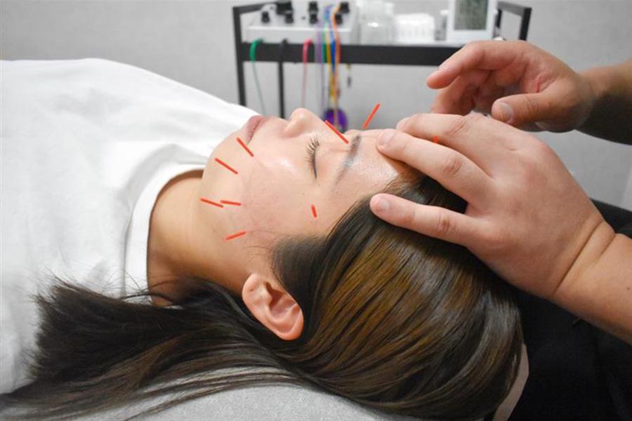 【新規限定】美容鍼 40分 通常料金12,000円