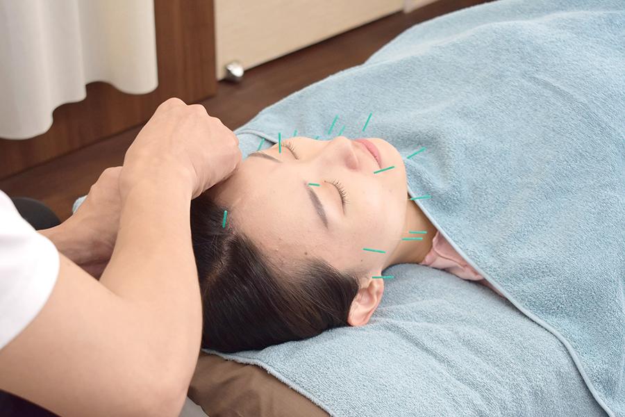 cosmetic acupuncture＋whole body care 90分