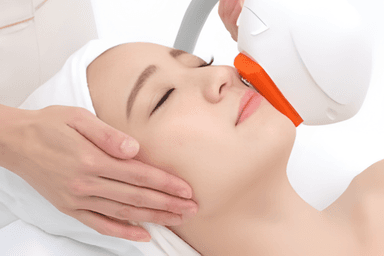 脱毛 顔全部 (OPT)