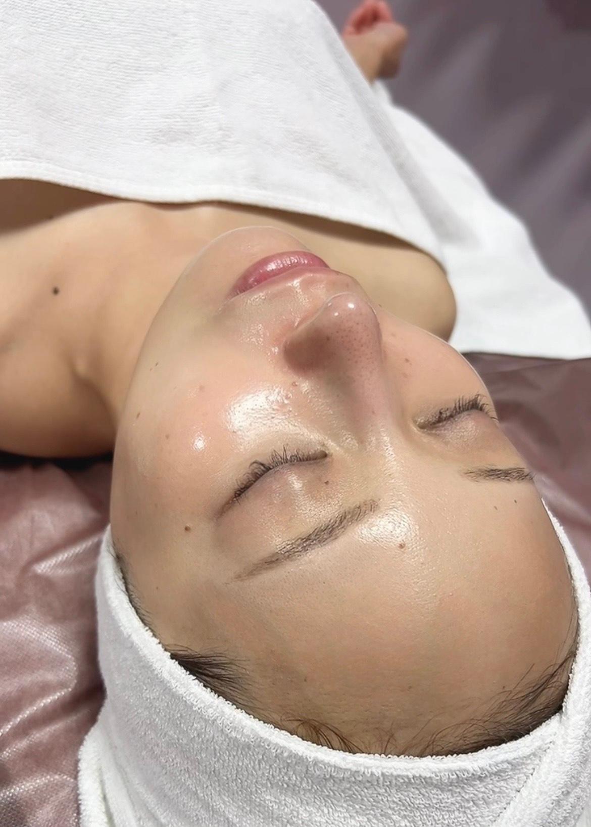 【2026年2月末日まで特別価格】【医療に頼らない若見え美肌】セレブピーリング