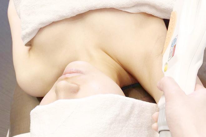 顔脱毛 ヒアリング込み60分