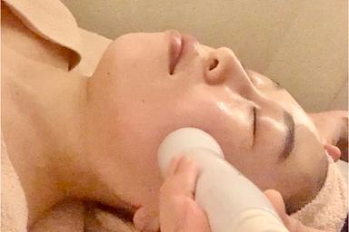 【輝肌】ポレーション導入エクソソーム50分