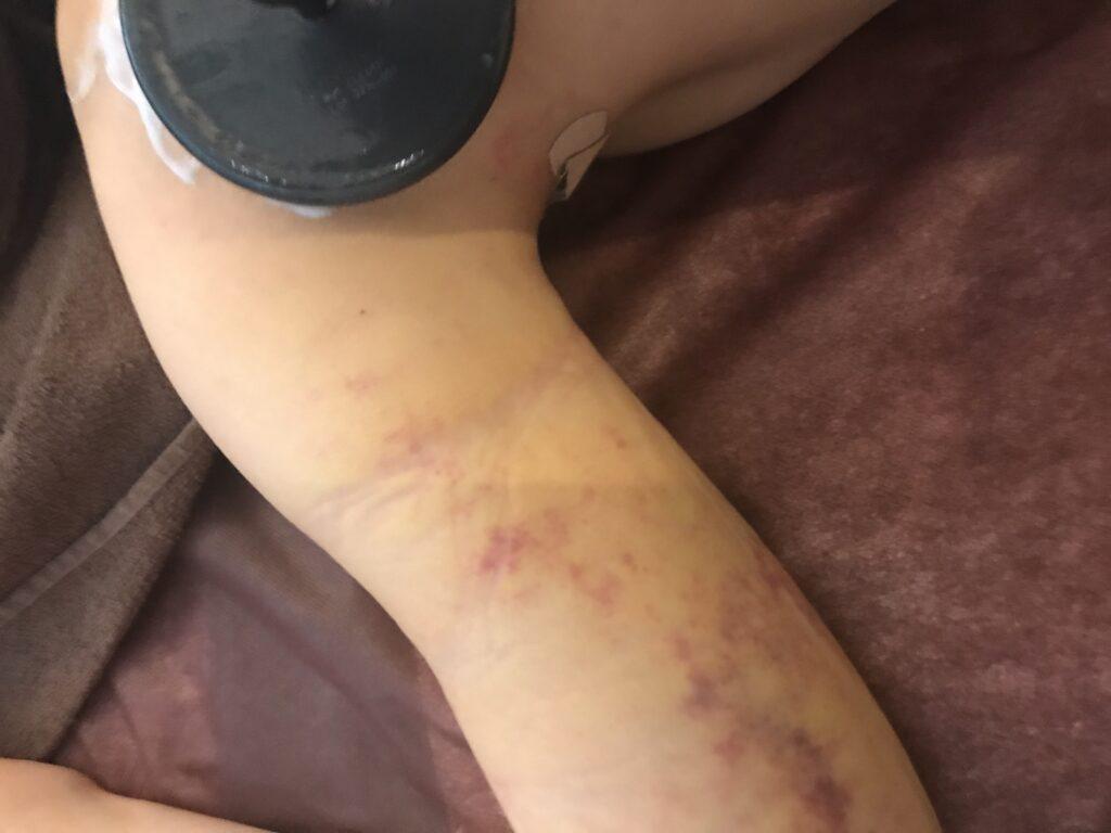 インディバ・ボディリカバリーサポートケア 90分