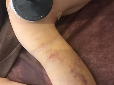 インディバ・ボディリカバリーサポートケア 90分